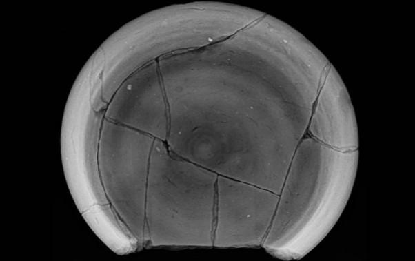 xray of roman dish