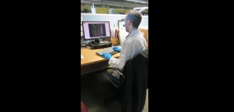 Editing digital x-ray images on a computer