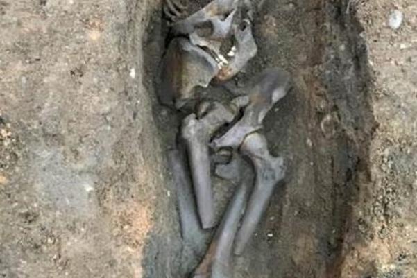 Anatomical dissection of adult male individual with displaced skull and circumferential craniotomy, removal of arms, displaced pelvis and sawn femora